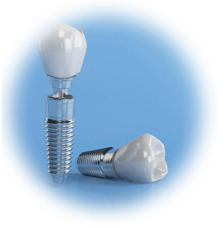 Les prothèses fixes au Cabinet dentaire InnovaDent à Aix-les-Bains